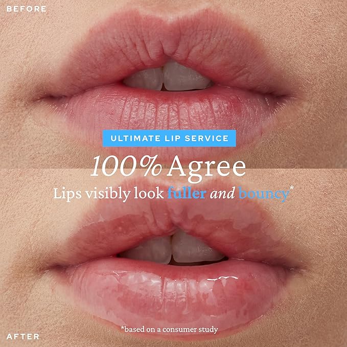 belif Super Knights Lipcerin - Plumping Lip Butter Balm with Hyaluronic Acid & Vitamin C | Hydrating Korean Lip Care for Teens & Women | Smooths Texture & Strengthens Barrier | Ideal Gift